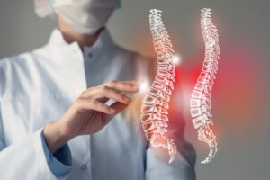 Spinal Injury Claims Guide 