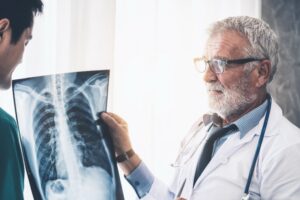 misdiagnosis of lung cancer