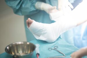 A doctor puts a broken leg into a cast with bandages