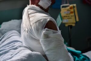 An upper body shot of someone sat upright in a hospital bed covered in bandages.