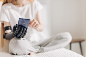 A person sitting in a bed and holding a phone. The arm holding the phone is a prosthetic.