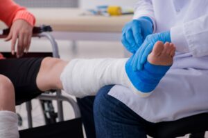 CLOSE UP OF A PERSON'S LEG IN A CAST AFTER A ROAD TRAFFIC ACCIDENT