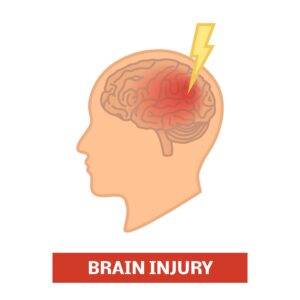 A brain injury graphic shown as the outline of a human head with the brain showing and part of the being highlighted in red with a lightening bolt. 