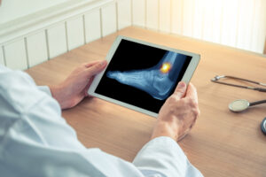 A doctor holding a digital tablet showing an image of an ankle x-ray