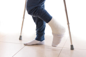 A man walking on crutches with his leg and ankle in a plaster cast